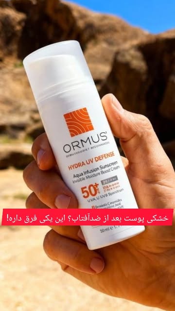 کرم ضد آفتاب اورموس پوست خشک